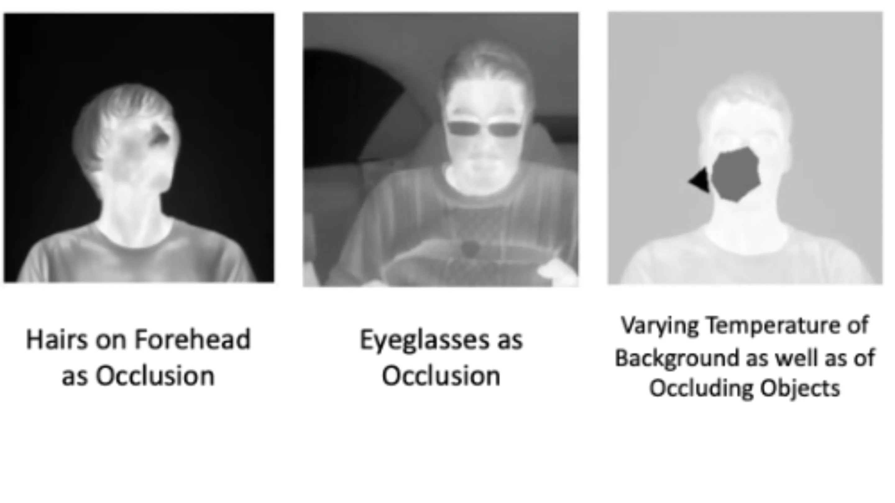 Photographs showing a persons face under infrared imaging are displayed