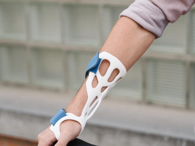 A man holding a bicycle seat with a 3d printed splint on his wrist